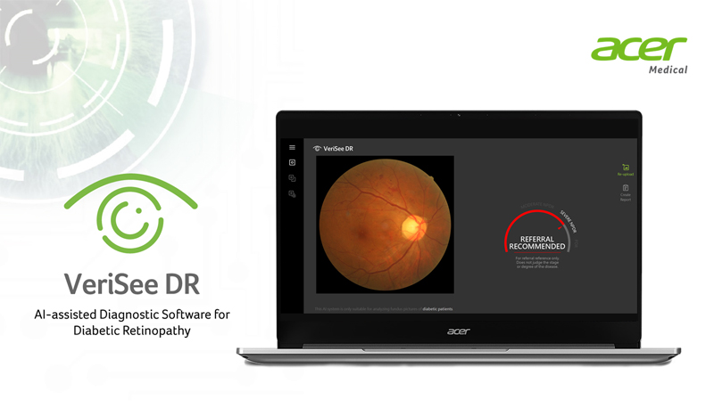 Acer to Expand Diabetic Retinopathy Screening by Launching AI-assisted Diagnostic Solution to Local Hospitals and Clinics